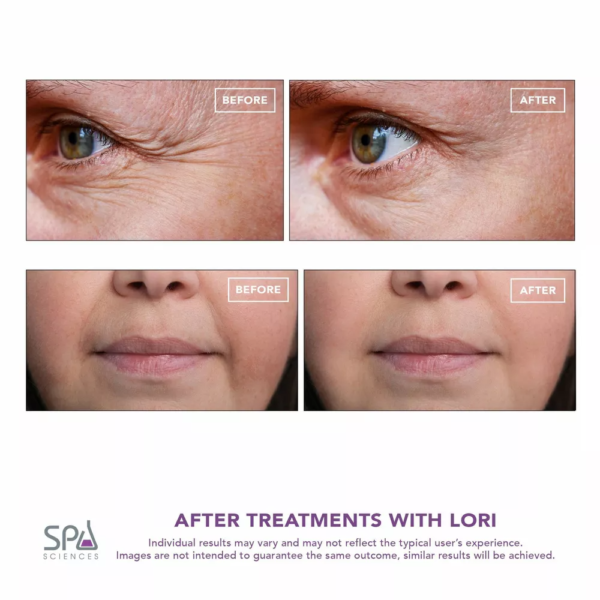 Spa Sciences LORI Eye Lip Anti-Aging`